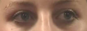 eye_movement.gif